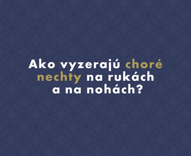 Ako vyzerajú choré nechty na rukách a na nohách?